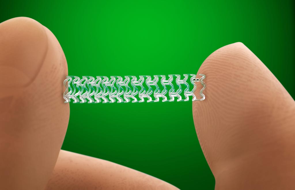 Advancements in Bioresorbable Implants Drive Market Growth