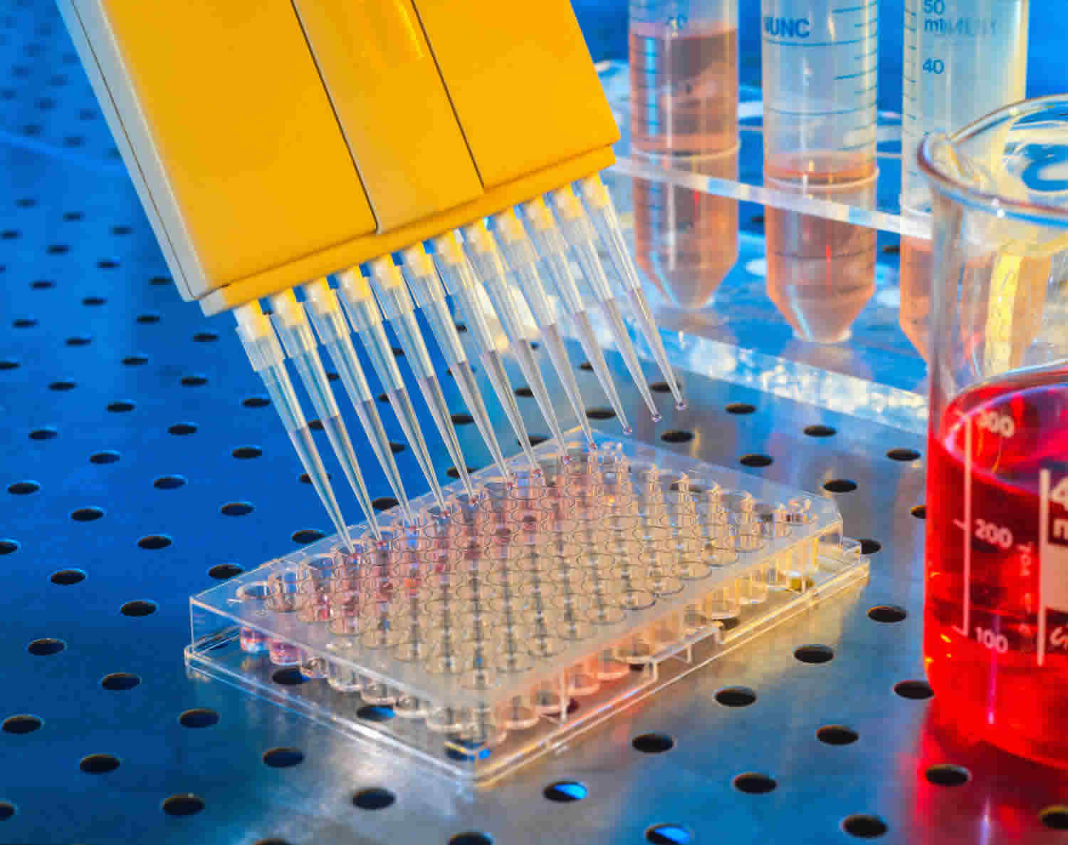 Global Enzyme Linked Immunosorbent Assay Market Is Estimated To Witness High Growth Owing To Rising Demand for Accurate Diagnostic Tests and Technological Advancements