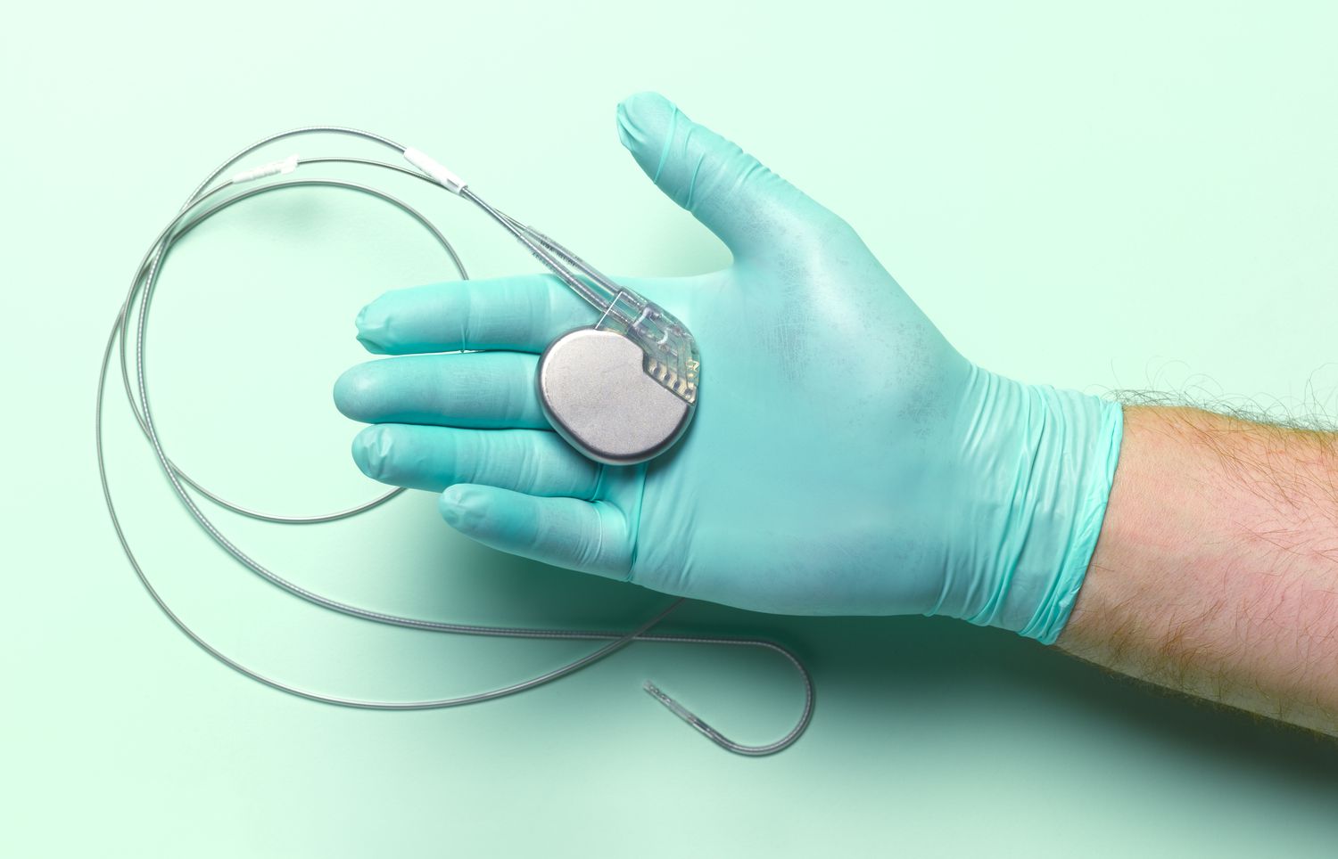 Future Prospects of the Active Implantable Medical Devices Market