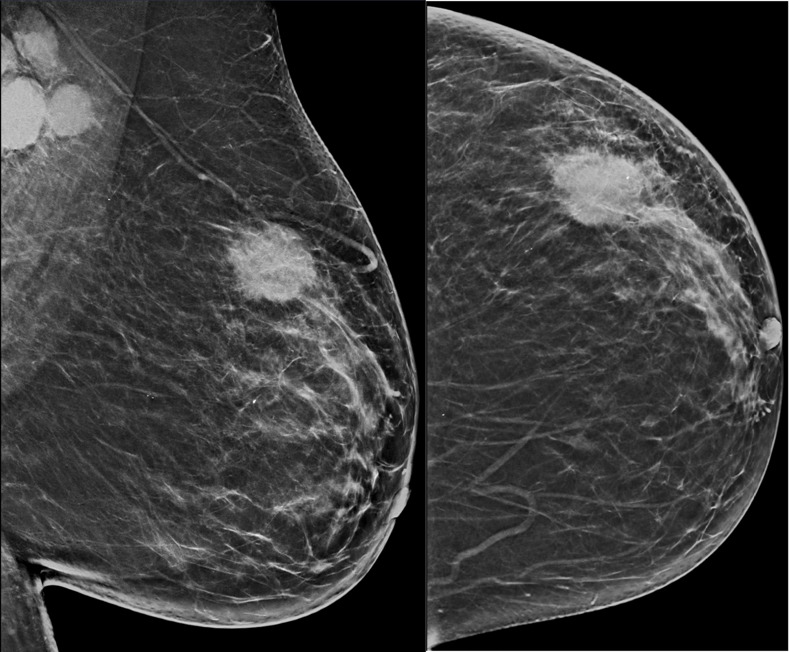 Breast Imaging Market Is Estimated To Witness High Growth Owing To Increasing Prevalence of Breast Cancer And Rising Demand for Early Detection Opportunities