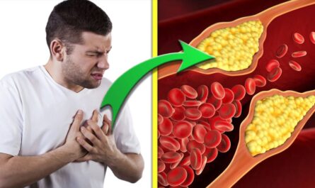 High Cholesterol Levels Identified as a "Silent Epidemic" in the UK