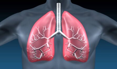 Idiopathic Pulmonary Fibrosis Treatment MArket
