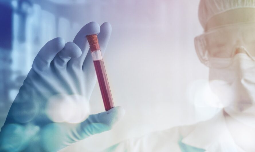 Artificial Intelligence To Drive Significant Growth In Liquid Biopsy Market