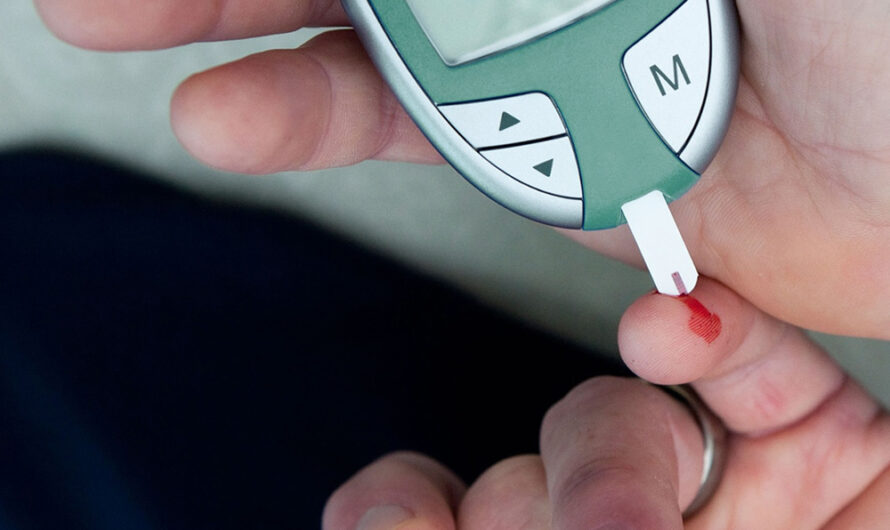 New Study Reveals Factors Driving Up Costs for Type 2 Diabetes Patients