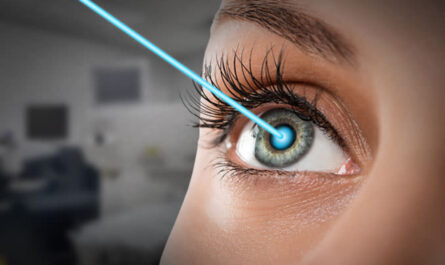 Laser Vision Correction Market