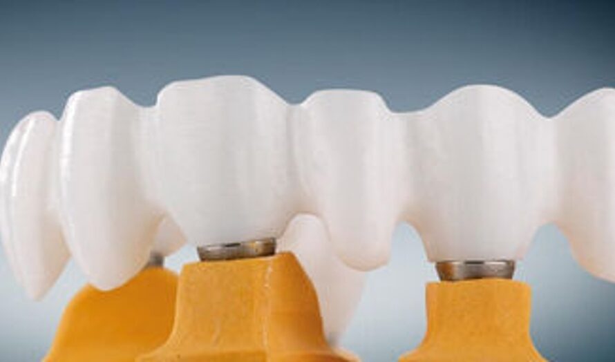 Zirconia Based Dental Materials Market is estimated to Witness High Growth Owing To Rising Esthetic Dentistry Procedures for Dental Crowns and Bridges