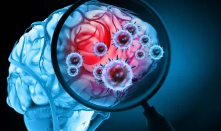 Brain Injury Caused by COVID-19 May Persist Despite Normal Test Results, Study Finds