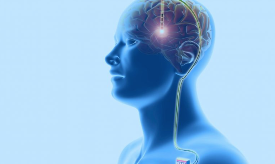 Promising Results for Novel Brain Stimulation Technique in Hard-to-Treat Depression Patients