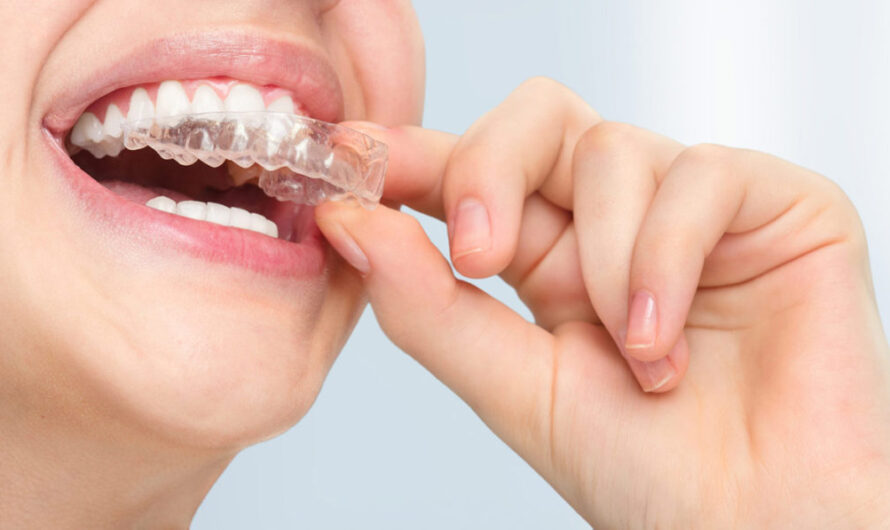 The Bruxism Treatment Market Driven By Growing Prevalence Of Mental Stresses