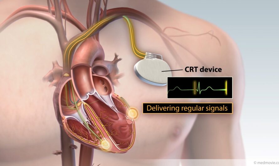 The Global Cardiac Autonomic Control Market Is Driven By Rising Prevalence Of Cardiovascular Diseases