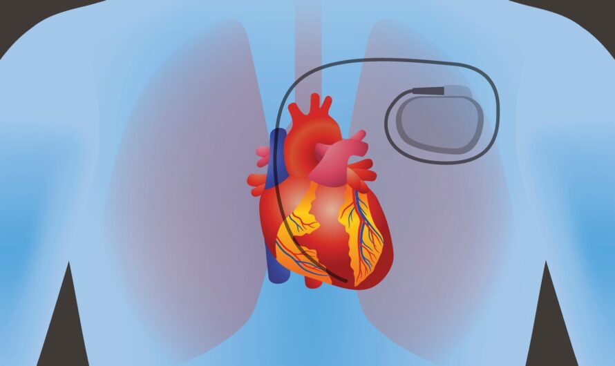 The Cardiac Implantable Electronic Device Market Is Driven By Rising Incidences Of Cardiovascular Disorders