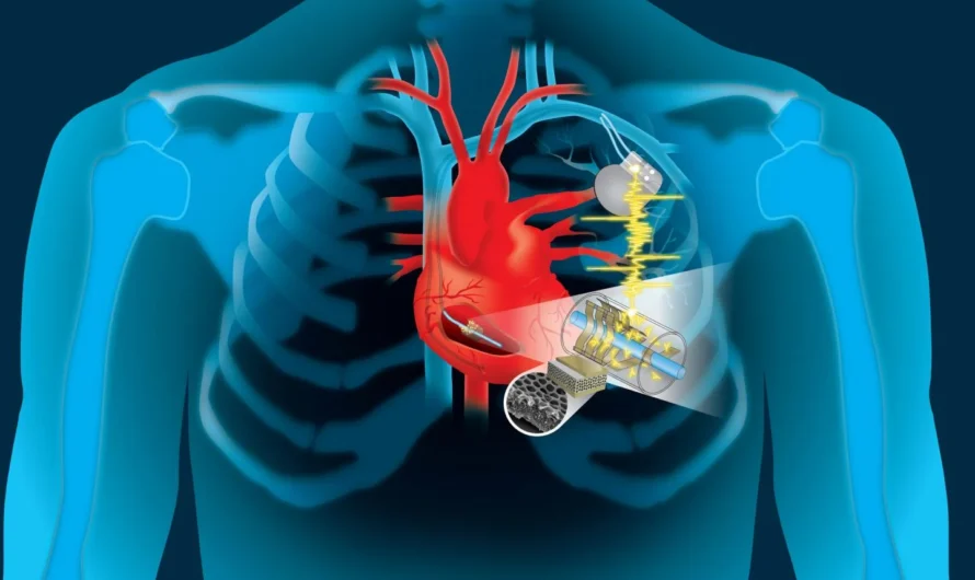 Rapid Growth in Geriatric Population is Projected to Boost the Cardiac Pacing Leads Market