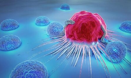Cell Therapy Demonstrates Safety and Efficacy for Lymphoma Patients in Remission