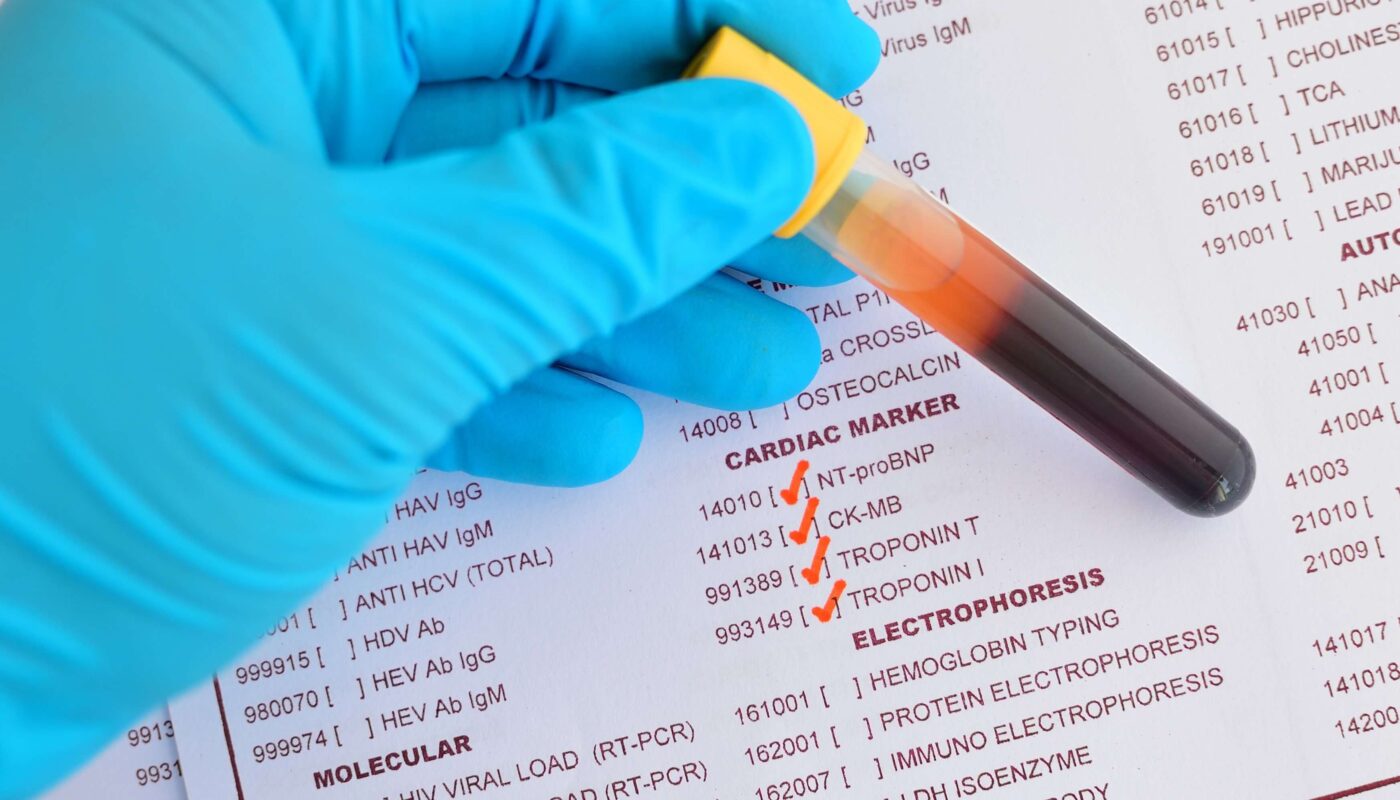 Highly Sensitive Blood Test Revolutionizes Emergency Diagnosis of Heart