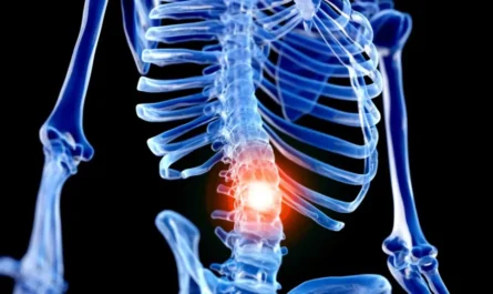 New Study Identifies Link Between Back Pain and Cells in Spinal 'Shock Absorbers'