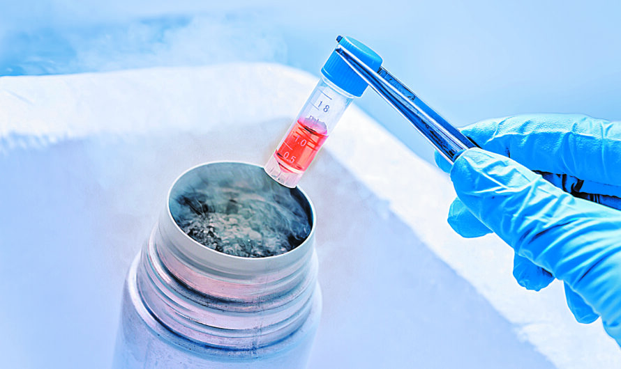 The Rising Demand For Preservation Of Tissues And Cells Is Driving The Cell Cryopreservation Market