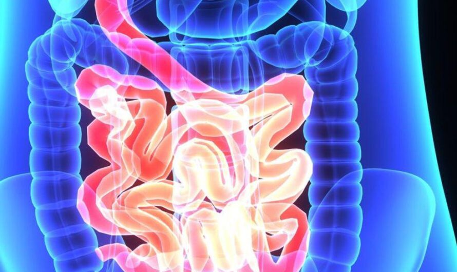 Beans Shown to Have Benefits for Patients with History of Colorectal Neoplasia
