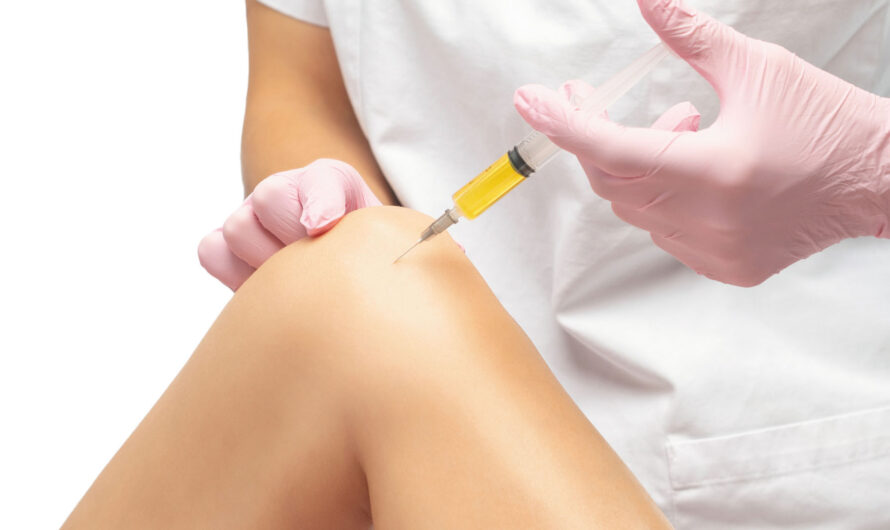 Platelet Rich Plasma Therapy in Europe is Projected to Driven by Rising Orthopedic Injuries