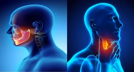 Head and neck cancer drugs market