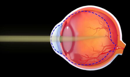 Myopia And Presbyopia Treatment Market