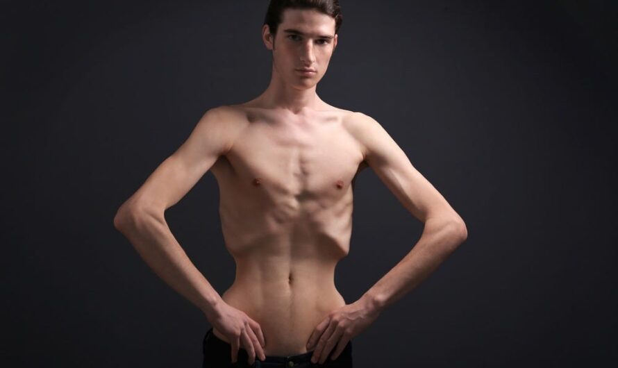 The Deadly Impact of Anorexia Nervosa in Males