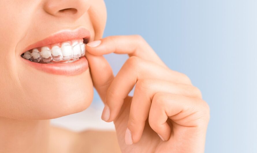 Bruxism Treatment Market IS Estimated TO Witness High Growth Owing TO Rising Stress Levels