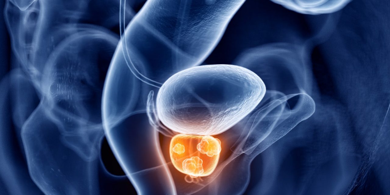 Global Castrate Resistant Prostate Cancer Market