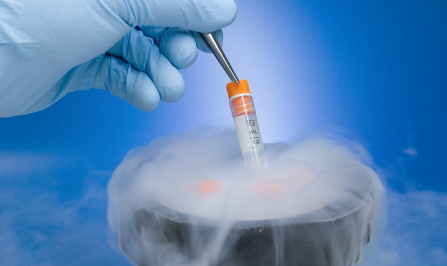 Cell Cryopreservation Market Is Estimated To Witness High Growth Owing To Increasing Usage Of Cryopreservation In Stem Cell Therapy And Organ Transplantation Procedures