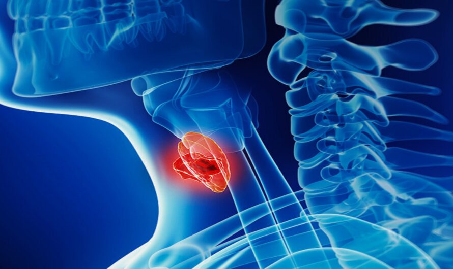 Hodgkins Lymphoma Treatment Market is Set for Growth Owing to Advancements in Endoscopy