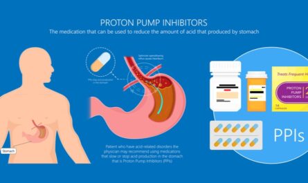 Proton Pump Inhibitors Market