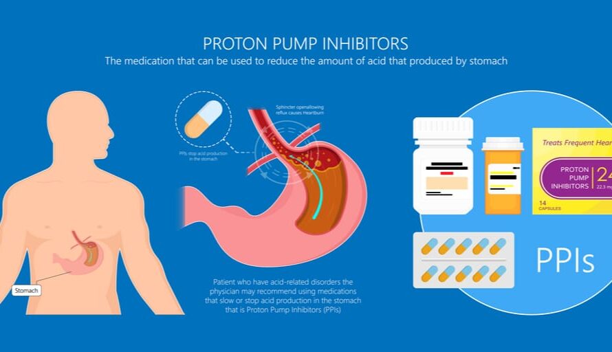The Proton Pump Inhibitors Market Is Trending By Population Health Awareness