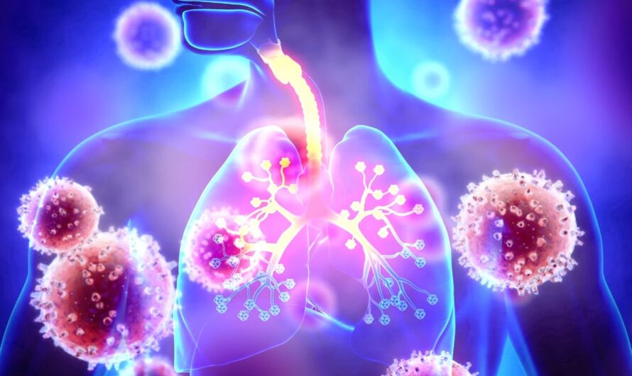 Respiratory Tract Infection Treatment Market Is Expected To Be Flourished By Rising Geriatric Population