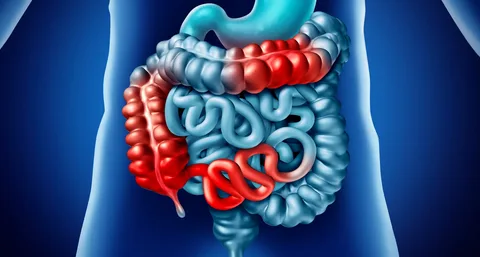 New Insights into Gut Immune System Provide Hope for Crohn’s Disease Patients