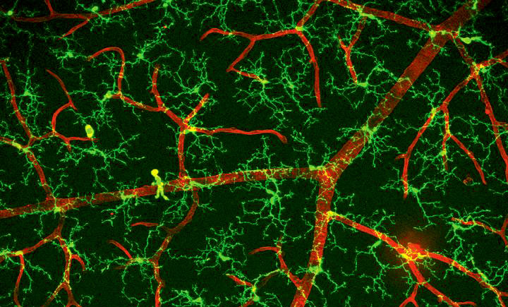 Deciphering the impact of microglia in Alzheimer’s disease progression