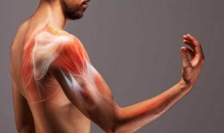 Muscle Spasticity Market
