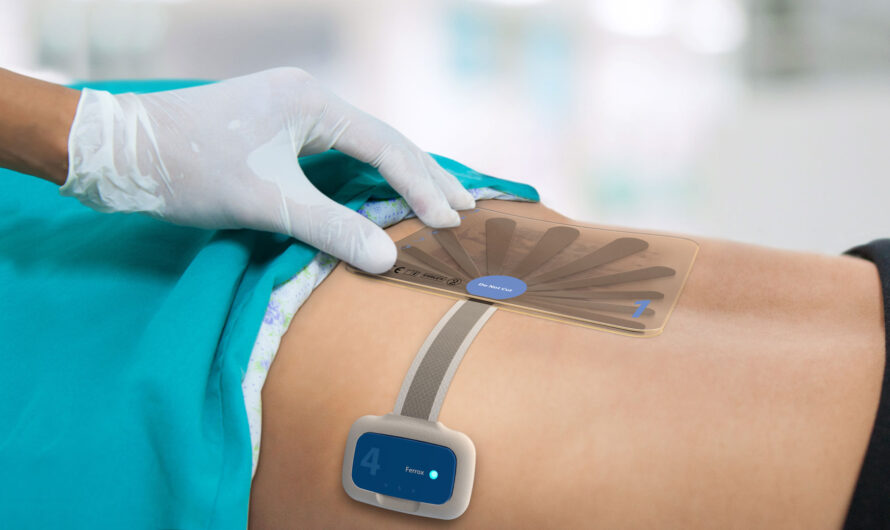Negative Pressure Wound Therapy (NPWT) Devices Market To Grow Amid Rising Incidences Of Diabetes-Related Chronic Wounds