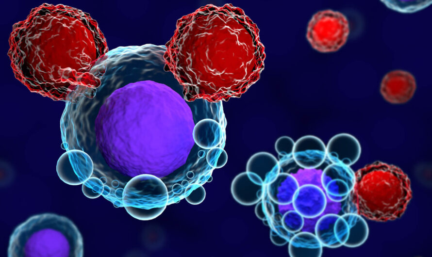 Cell Therapy Manufacturing: Advancing Therapies for Previously Untreatable Diseases