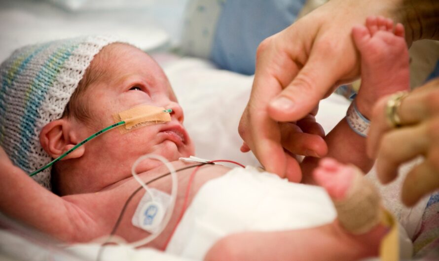 Azithromycin’s Role in Preventing Chronic Lung Disease in Premature Babies: A Large-Scale Clinical Trial