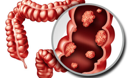 Colorectal Cancers