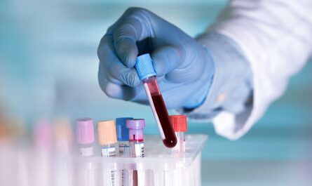 Liquid Biopsy